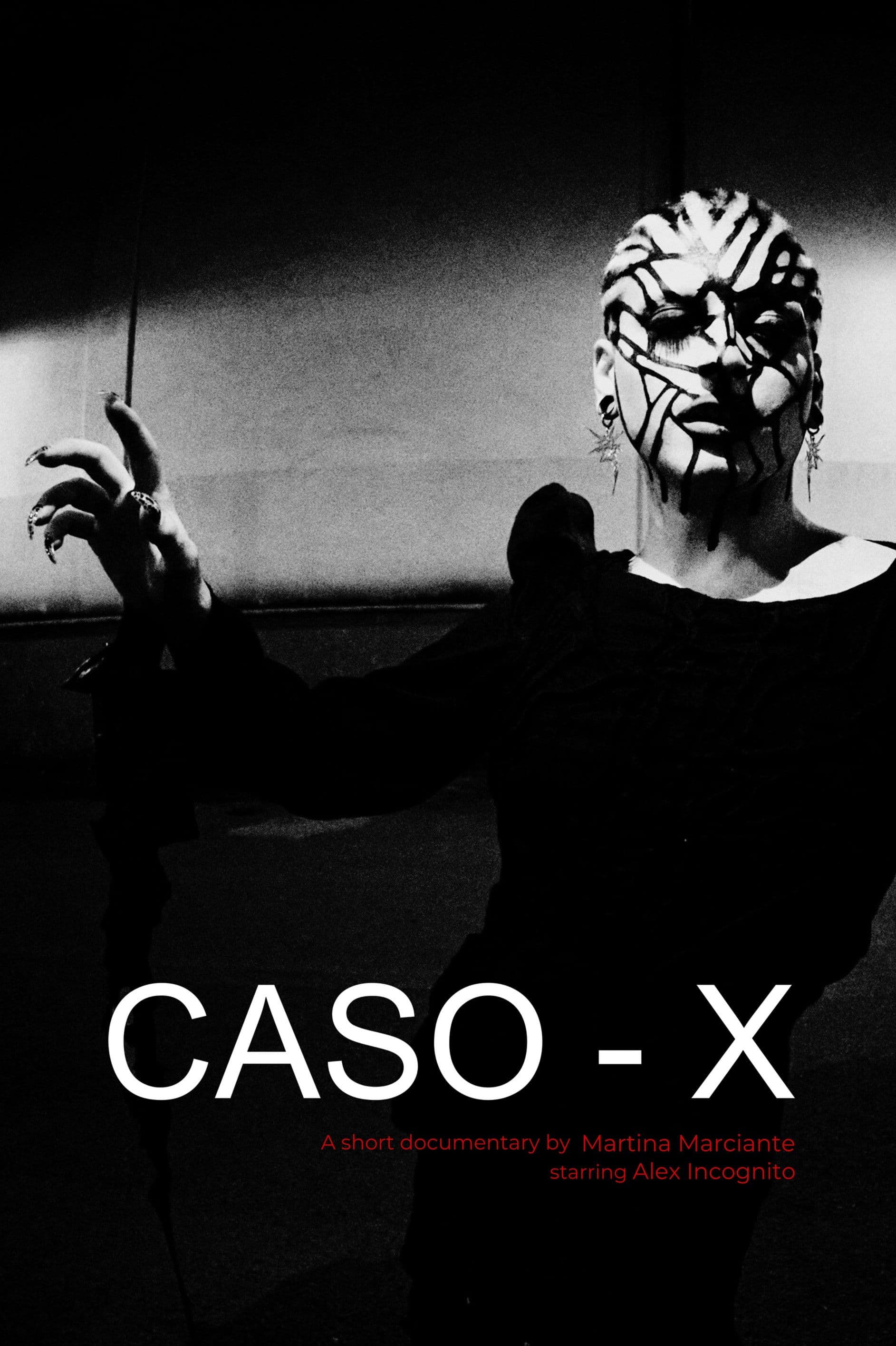Caso - X