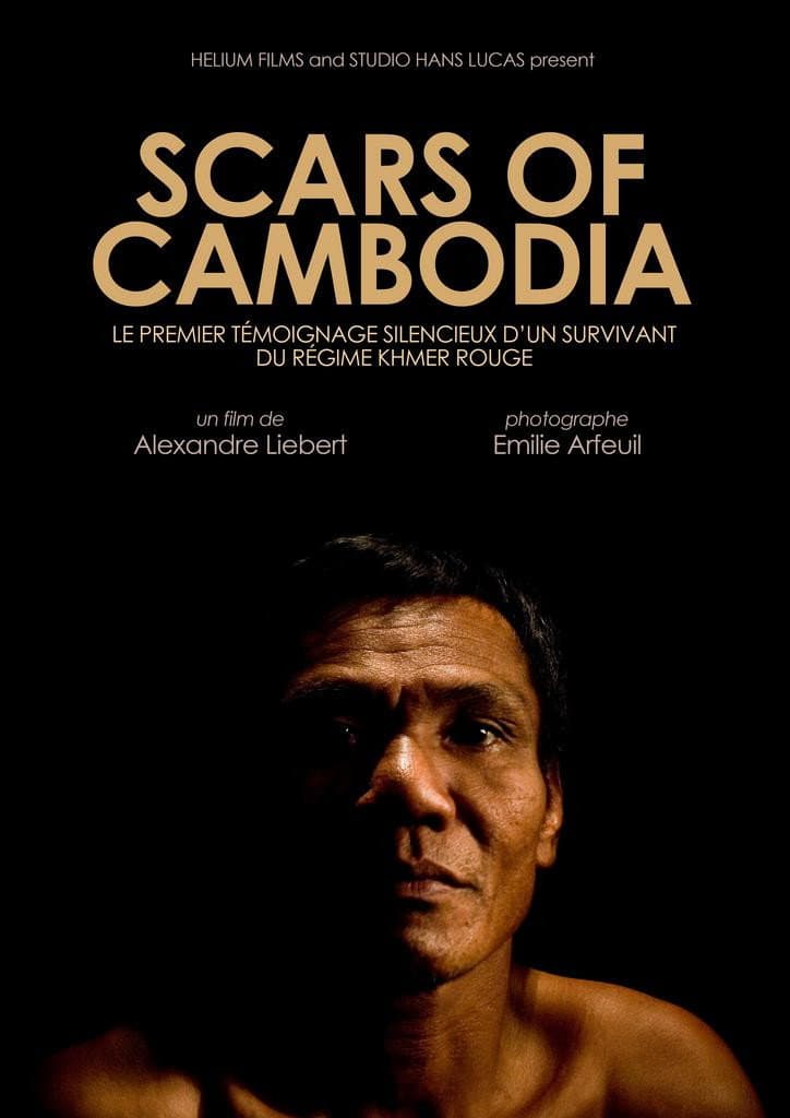 Scars Of Cambodia