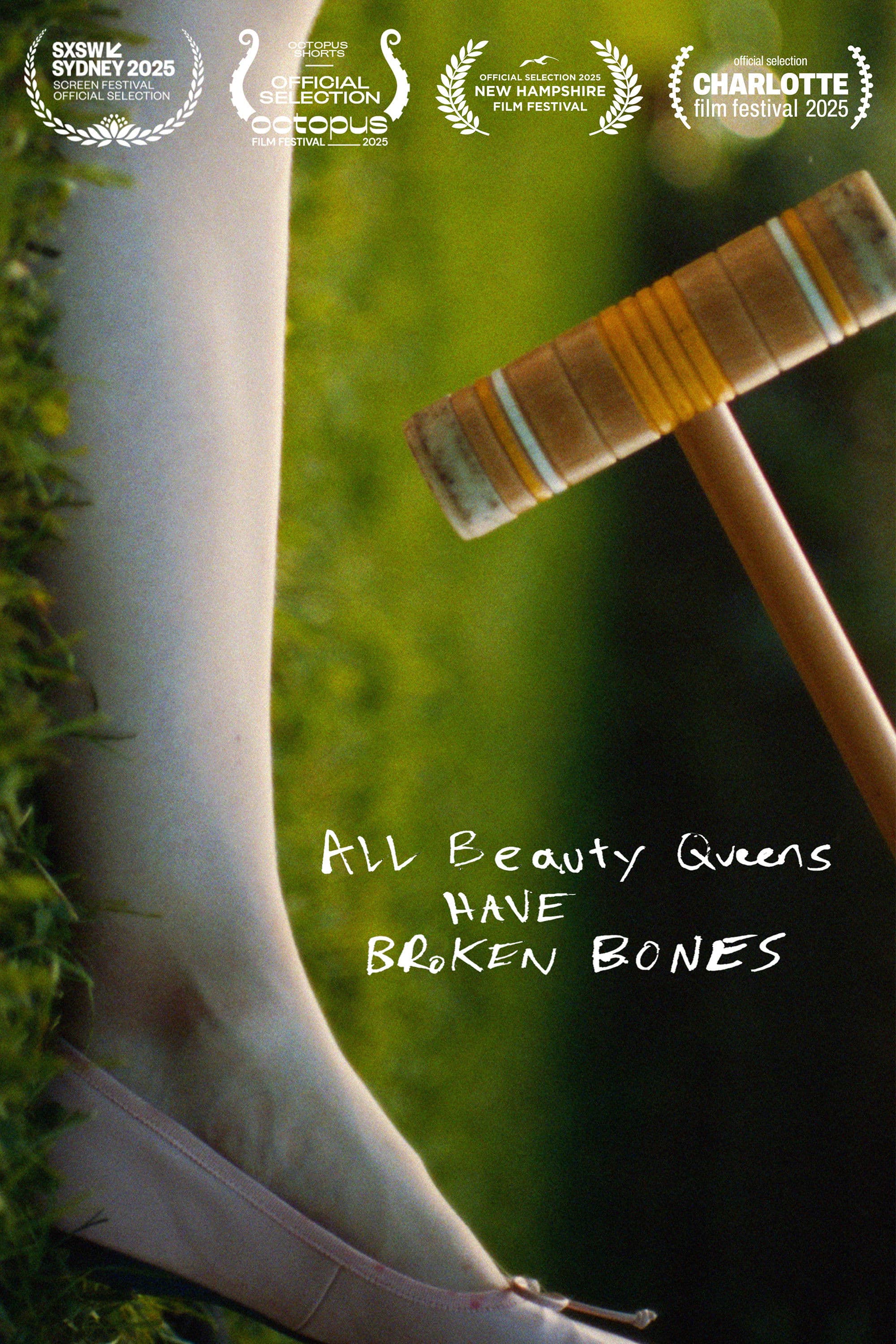 All Beauty Queens Have Broken Bones