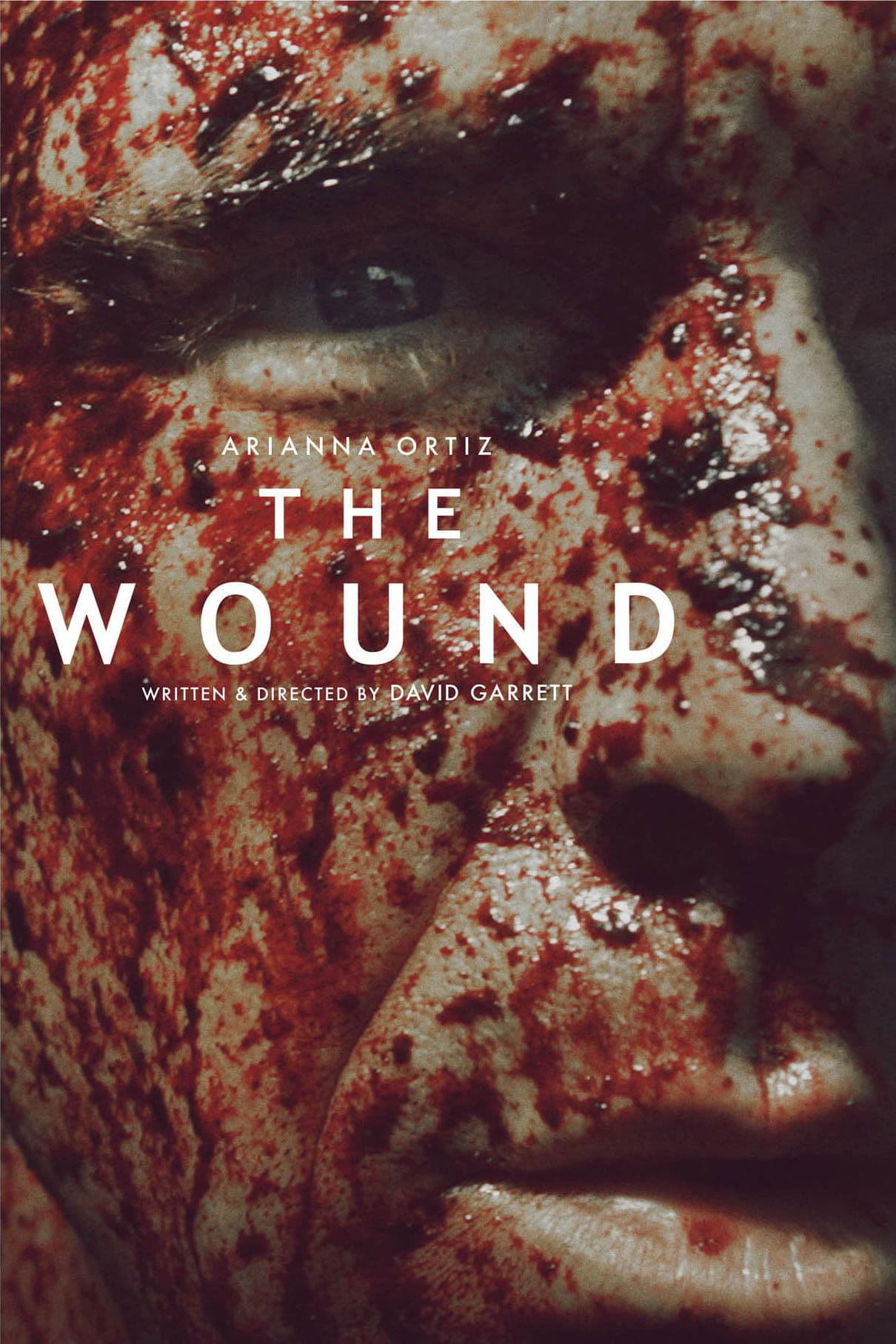 The Wound