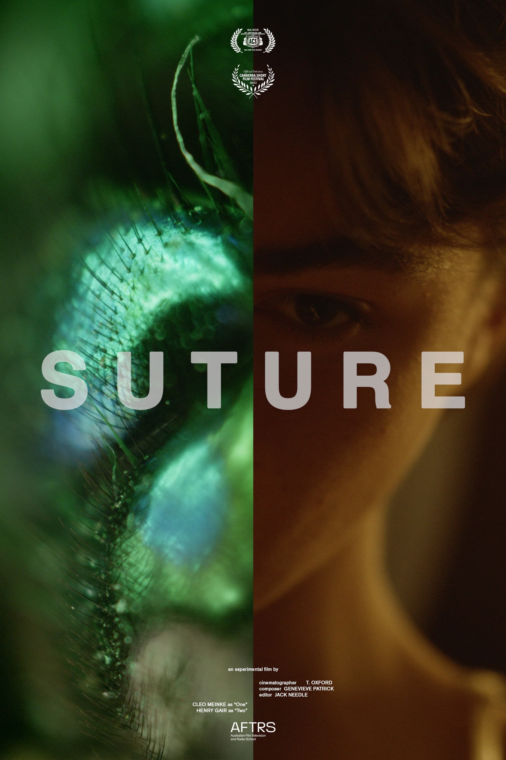 Suture
