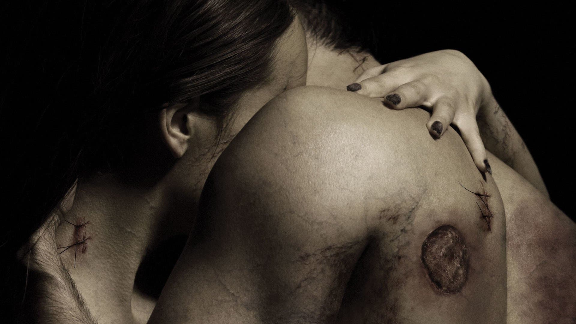 Contracted Collection