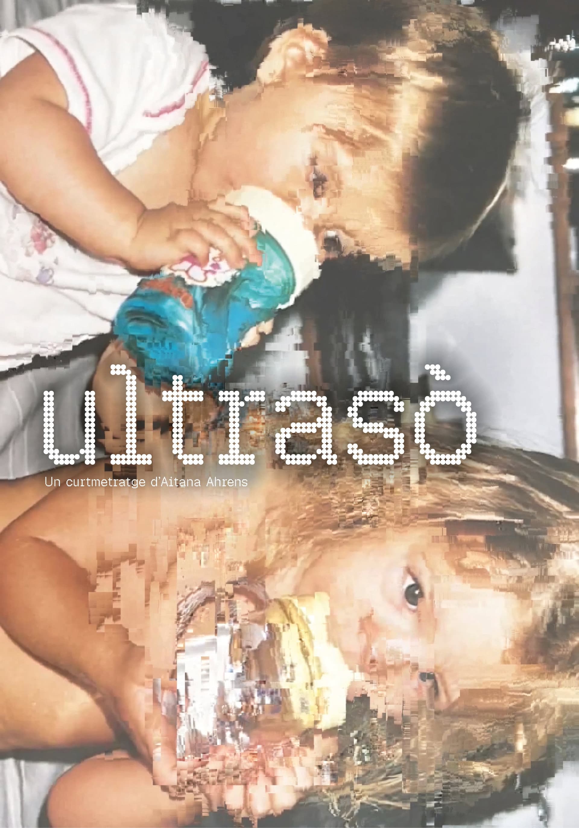 Ultrasound