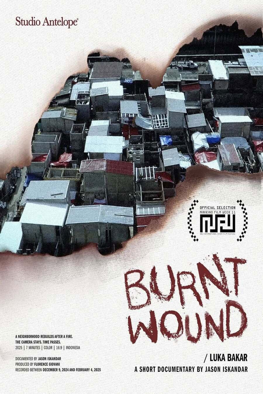 Burnt Wound