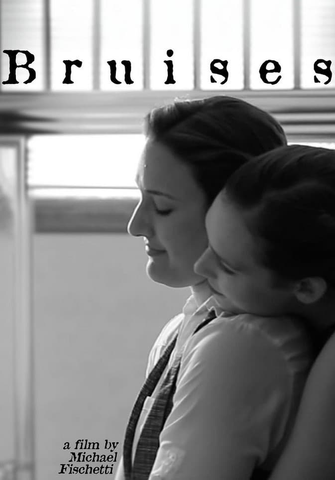 Bruises