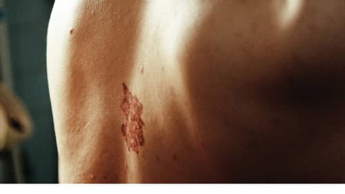 Original Wound poster