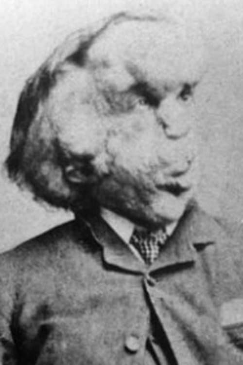 Joseph Merrick profile photo