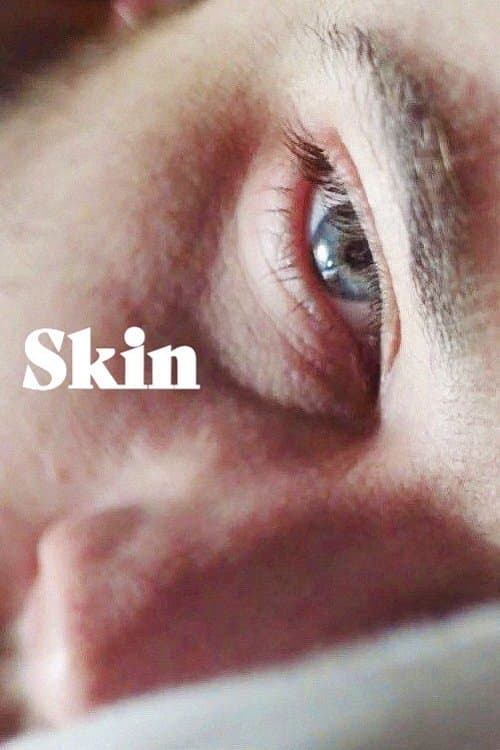 Skin poster