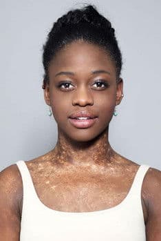 Michaela DePrince profile photo