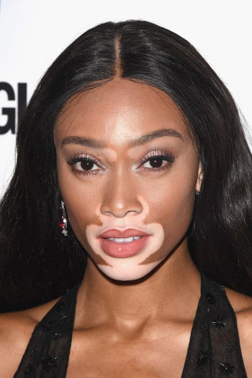 Winnie Harlow profile photo