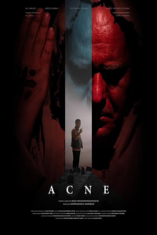Acne poster
