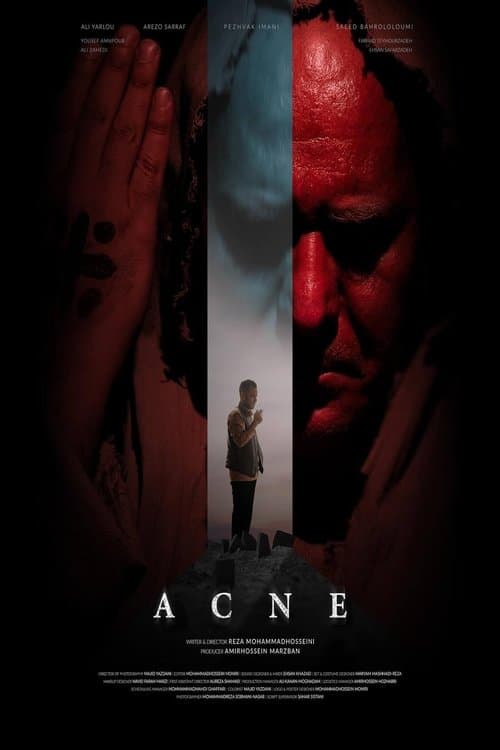 Acne poster