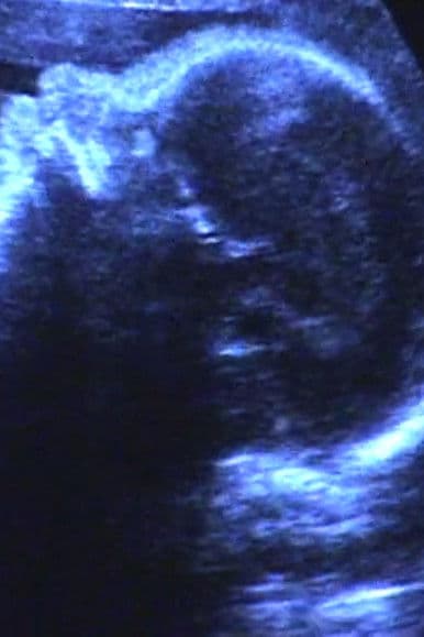 A Short Film for Lida poster