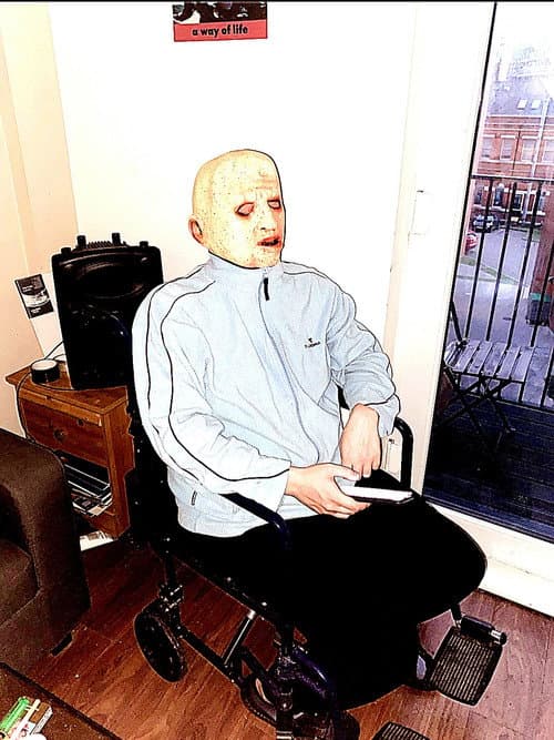Anecdotes of a Baldmen poster