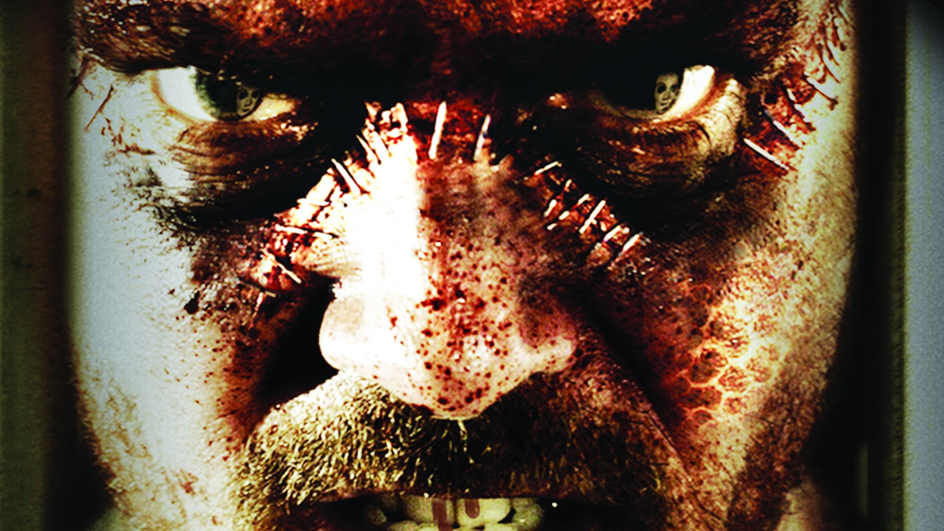 The Frankenstein Syndrome