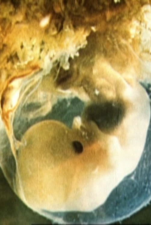 Schwangerschaft und Geburt